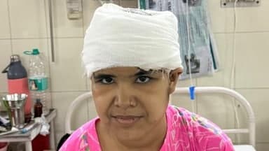 राजस्थान के एस. एम. एस. अस्पताल ने जटिल सर्जरी में महिला के सिर से 4 किलो का ट्यूमर निकाला